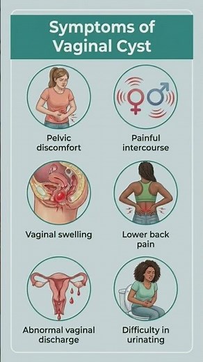 Vaginal Cyst Warning Signs (Pain, Swelling & More) #cancer #healthtips #usa