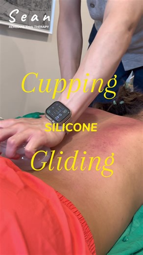 ครอบแก้ว | Cupping | 拔罐 • การใช้ครอบแก้วร่วมกับการนวดบำบัด เป็นการส่งเสริมให้กล้ามเนื้อและพังผืดคลายตัวได้เร็วมากขึ้น โดยครอบแก้วจะสร้างแรงดูด ให้เลือดไหลเวียนบริเวณที่ครอบแก้วมากขึ้น รวมทั้งการเคลื่อนแก้วตามแนวกล้ามเนื้อ ช่วยเพิ่มประสิทธิภาพในการคลายกล้ามเนื้อ และเพิ่มช่วงการเคลื่อนไหวของข้อต่อ • Combining cupping with massage therapy helps promote rapid relaxation of muscles and fascia. The suction created by the cups increases blood circulation, while sliding cupping techniques along the musc