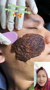 1.3M views · 2.5K reactions | Tutorial penghilang tompel menyala mantulnya﫰邏 #vidioreels #jangkauanluas #semuaorang #pengikut #fypfbpro #monetisasikonten #interaksi #pemula #sorotan #kecantikan | Edelweis Flower | Facebook