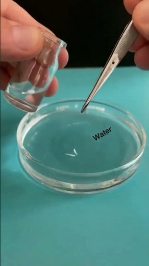 chromosomes under microscope #mitosis