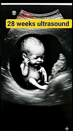 28 Weeks Pregnant Ultrasound | Baby Growth & Development in Womb#pregnant #ultrasound #pregnancytips