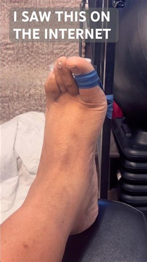 This Simple Plantar Fasciitis Fix Changes Everything #warning #feet
