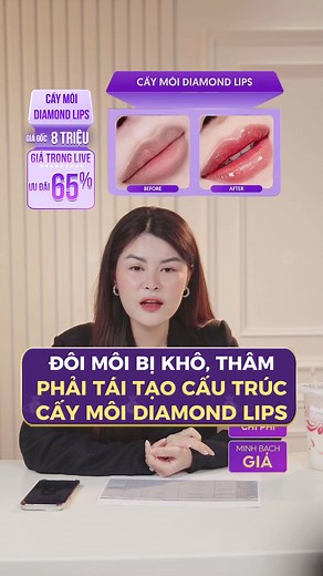Tạm biệt đôi môi khô, thâm xỉn, sở hữu ngay môi hồng căng bóng chỉ sau 60 phút. Tặng ƯU ĐÃI 65% cho 5 chị em đăng ký sớm nhất #lamdep #thammylinhanh #phunmoi #caymoidiamondlips #phunmoidep #phunmoitunhien #phunmoikithuatchauau #caymoisinhhoc