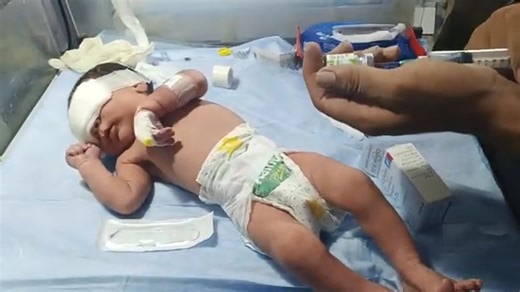 How to Pass IV Line to a Newborn Baby in the NICU | Step-by-Step Guide for Nurses & Doctors. In this video, we provide a detailed step-by-step guide on how to insert an IV (intravenous) line to a newborn baby in the NICU (Neonatal Intensive Care Unit). Learn the proper technique, precautions, and safety measures required during IV insertion in critical care neonatal settings. Ideal for NICU nurses, pediatricians, and medical students. #NICUBabyCare #NewbornIVInsertion #PediatricNursing #NICUTrai