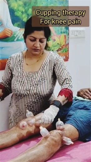 cup therapy for knee #ytshorts #cuppingtherapy #cupping