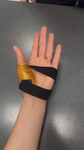 Hand Therapy Group on Instagram: "Here is how we make a short opponens orthosis which we use to treat a range of different thumb conditions. This splint is very functional as the fingers, wrist and thumb IP remain free 👍🏽🙌🏽 #handtherapygroup #handtherapy #hand #hands #handtherapist #occupationaltherapy #physiotherapy #ot #pt #splints #shortopponens #thumbinjury"