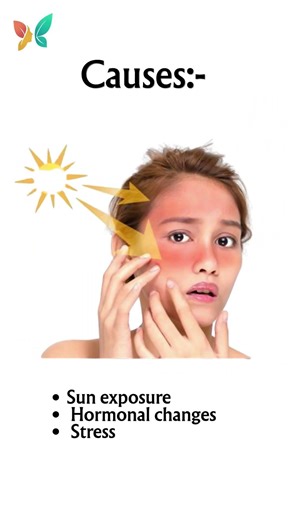 ✨ Skin Pigmentation – Understand the Cause & Protect Your Skin! ✨