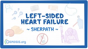 Case study - Left-sided heart failure: Nursing: Video & Causes | Osmosis