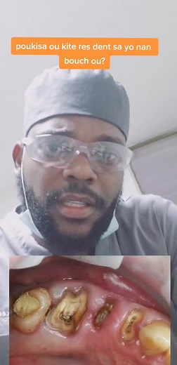 Understanding Tooth Decay: Causes and Solutions