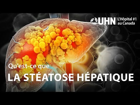 L'UHN Explique : La stéatose hépatique | UHN Explains: Fatty Liver Disease