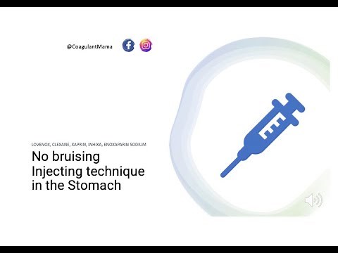 No bruise Injection technique ￼￼in Stomach for Lovenox, Clexane, Xaprin and Enoxaparin Sodium Part 1