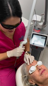 5.6K views · 11 reactions | Sunspots on the face, also known as age spots or solar lentigines, are areas of hyperpigmentation caused by prolonged exposure to the sun's ultraviolet (UV) rays. They typically appear as flat, brown spots on the skin and are more common in areas frequently exposed to the sun, such as the face, hands, shoulders, and arms. Sunspots on the face are generally harmless but can be cosmetically undesirable for some people. | Newcastle Cosmetic Doctor | Facebook