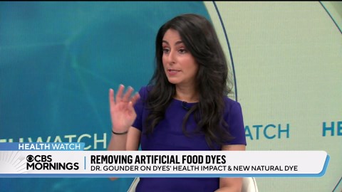 How artificial food dyes impact your health