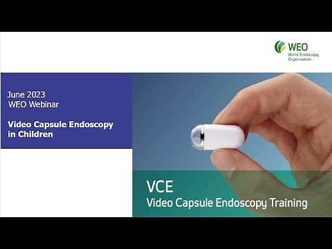Video Capsule Endoscopy in Children