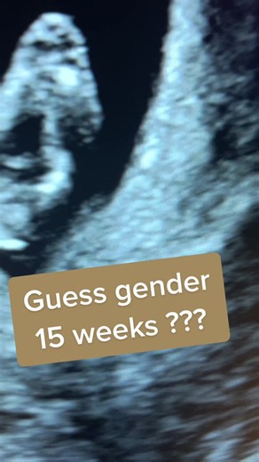 15 Weeks Gender Ultrasound Revealed: Boy or Girl?