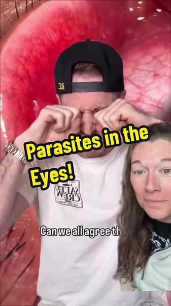 Parasites in the Eyes: Understanding Eye Health Risks
