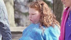 12-year-old gets gastric bypass surgery