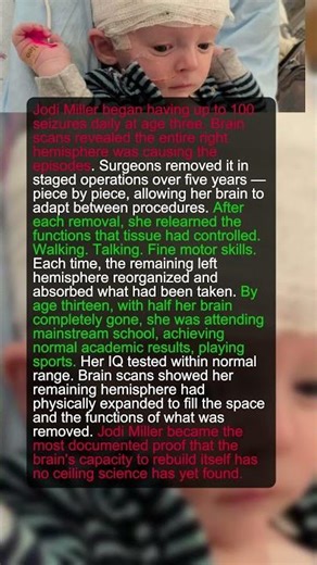A Girl's Brain Was Removed in Slices Over 5 Years. She Learned to Walk Again Each Time.