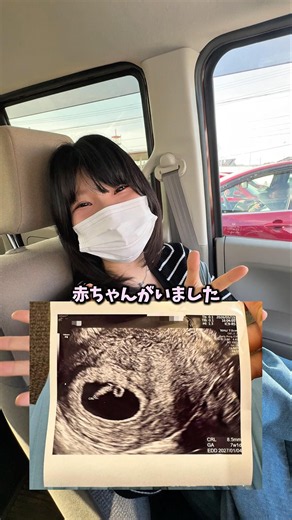 赤ちゃんの心拍を確認しにいく