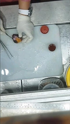 Tissue processing in Histopathology laboratory😱| #histology #museum #Histopathology #mounting