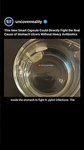 This Smart Capsule Could Directly Fight the Real Cause of Stomach Ulcers. Here's How #shorts #doctor