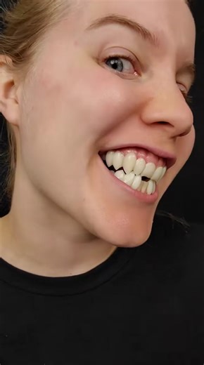 From Cute to Creepy: Transforming with Custom Fangs