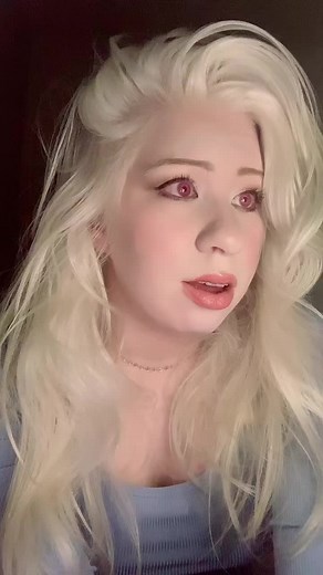 Celebrating Albinism: Embracing Confidence and Beauty in Unique Eyes