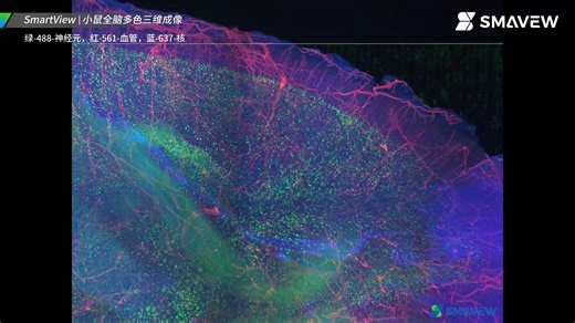 小鼠全脑多色三维成像，MacroView光片显微镜拍摄