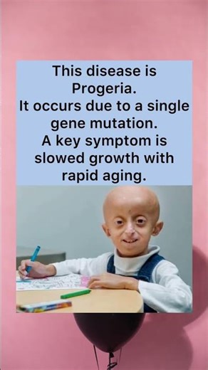 Living With Progeria #Progeria #RareGenetic