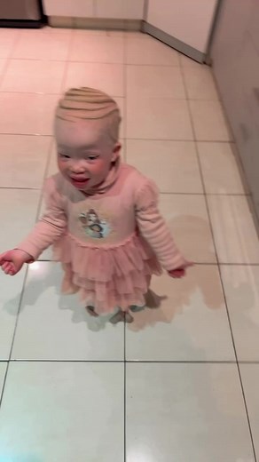 Adorable Albino Baby Dancing for Joy South Africa