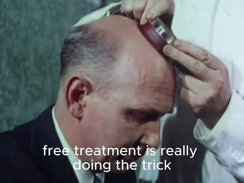 This Is How Baldness Was Treated in the 1950s