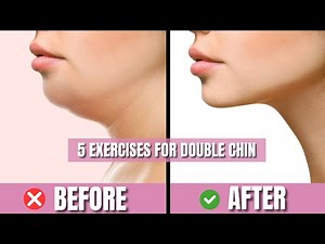 5 Effective Exercises to Reduce Your Double Chin Fastly!