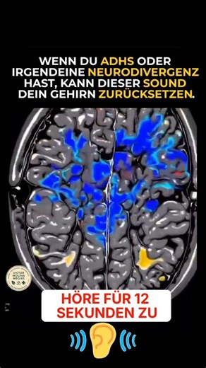 Wenn du ADHS oder irgendeine Neurodivergenz hast, kann dieser Sound dein Gehirn zurückset #shorts
