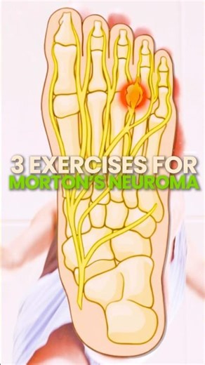 Morton's Neuroma doesn't have to be a dead end.
