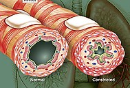 ASTHMA - SCHOOL NURSING 101