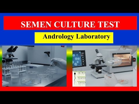SEMEN CULTURE TEST -Definition , Uses , Need , Preparation , Results , Normal Values