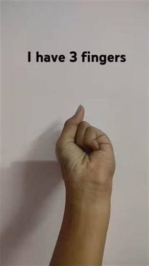 I Have 3 Fingers 😱🤓 #shorts #viral #magic #comedy