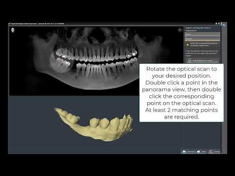 Sicat Implant: Prepare Data – Optical Impression
