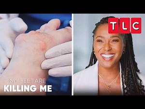 Most Mysterious Growths | My Feet Are Killing Me | TLC