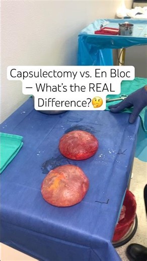 Capsulectomy vs En Bloc — here’s the difference explained simply. #breastimplantremoval