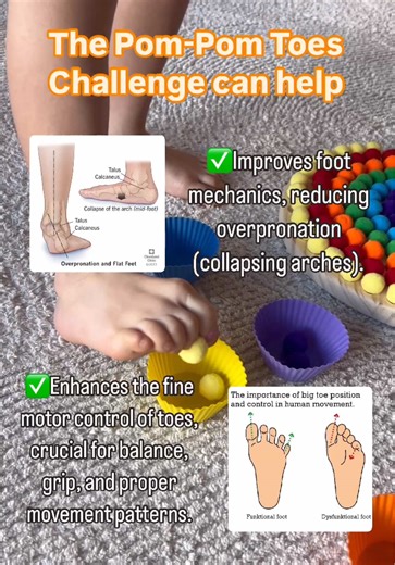 Correcting Flat Feet: Kids' Posture and Foot Health