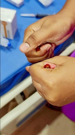 Rejunex Forte Injection Pulling 💉😱