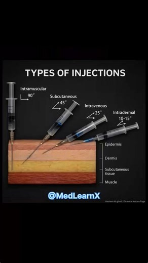 💉 Types of Injections Explained |#trending #shorts #shortsfeed#viral #reels #calisthenics #ytshorts