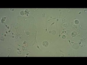 Infecunditatem. Cervix. Test Postcoital (PCT). IN VIVOS. 4h.