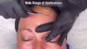 10 PCS Scalpel Blades with #10 Scalpels Surgical Blades,Disposable Blades with Protective Cover,Laboratory Blade-Lab Knives- Carving Blades with Handle-Art Blades Practicing Cutting-Crafts & More