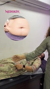 Advanced Tesla Obesity Machine for Fat Loss | Mediskin Ongole