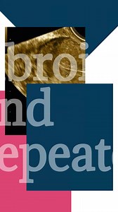  Did you know that there are common causes of Asherman Syndrome, a...