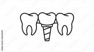 Animated prosthesis linear icon. Endosseous implant. Dental surgery. Tooth replacement. Seamless loop HD video with alpha channel on transparent background. Outline motion graphic animation