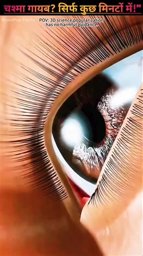 BrainPop Facts | 3D Biology Animation on Instagram: ""Laser Eye Treatment Hindi | 15 Minute LASIK Surgery Details" #LaserEyeSurgery #LASIK #LASIKSurgery #viral #LaserEyeTreatment #LaserSurgeryHindi #NoMoreGlasses #VisionCorrection #EyeSurgery #HealthShorts #HindiShorts #viralreels #YouTubeShorts #instagram #ShortsVideo"