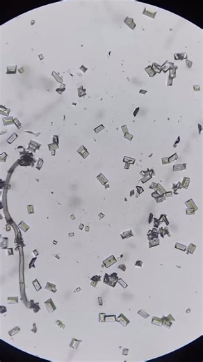 Microscope Examination Insights: A Close-Up View